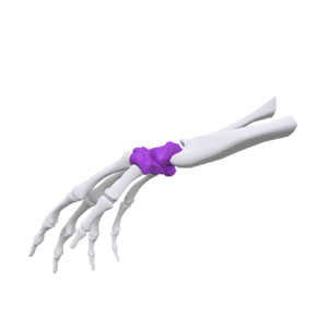 Ortopedi