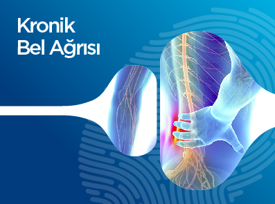 Kronik Bel Ağrısı